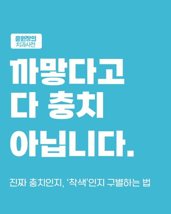 이게 충치일까? 그냥 착색일까? 스스로 구분하는 방법