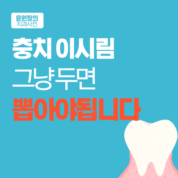 충치 이시림, 그냥 두면 결국 뽑아야 됩니다.