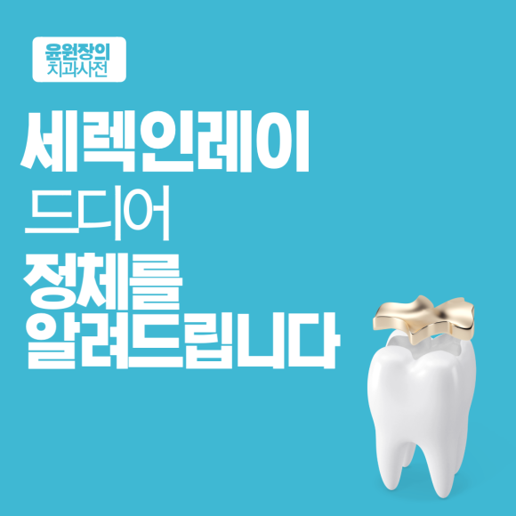 세렉인레이, 드디어 정체를 알려드립니다.