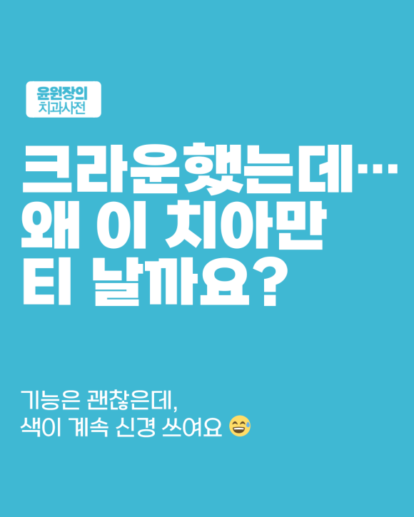크라운 색이 티 나는 이유… 자연스럽게 만드는 기준은?