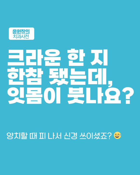 크라운 주변 잇몸이 붓는다면? 경계부 확인이 필요한 이유