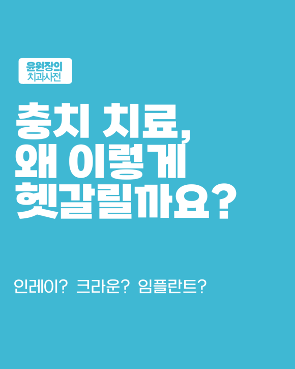 인레이, 크라운, 임플란트, 어떤 순서로 선택해야 할까?