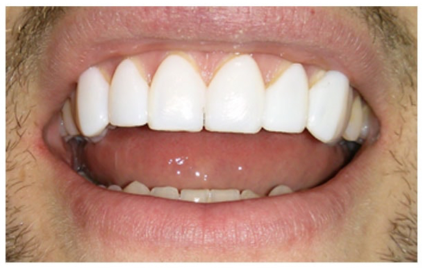 라미네이트 색상, 어떻게 고를까? ‘티 안 나는 자연스러움’의 기준 관련 이미지 3