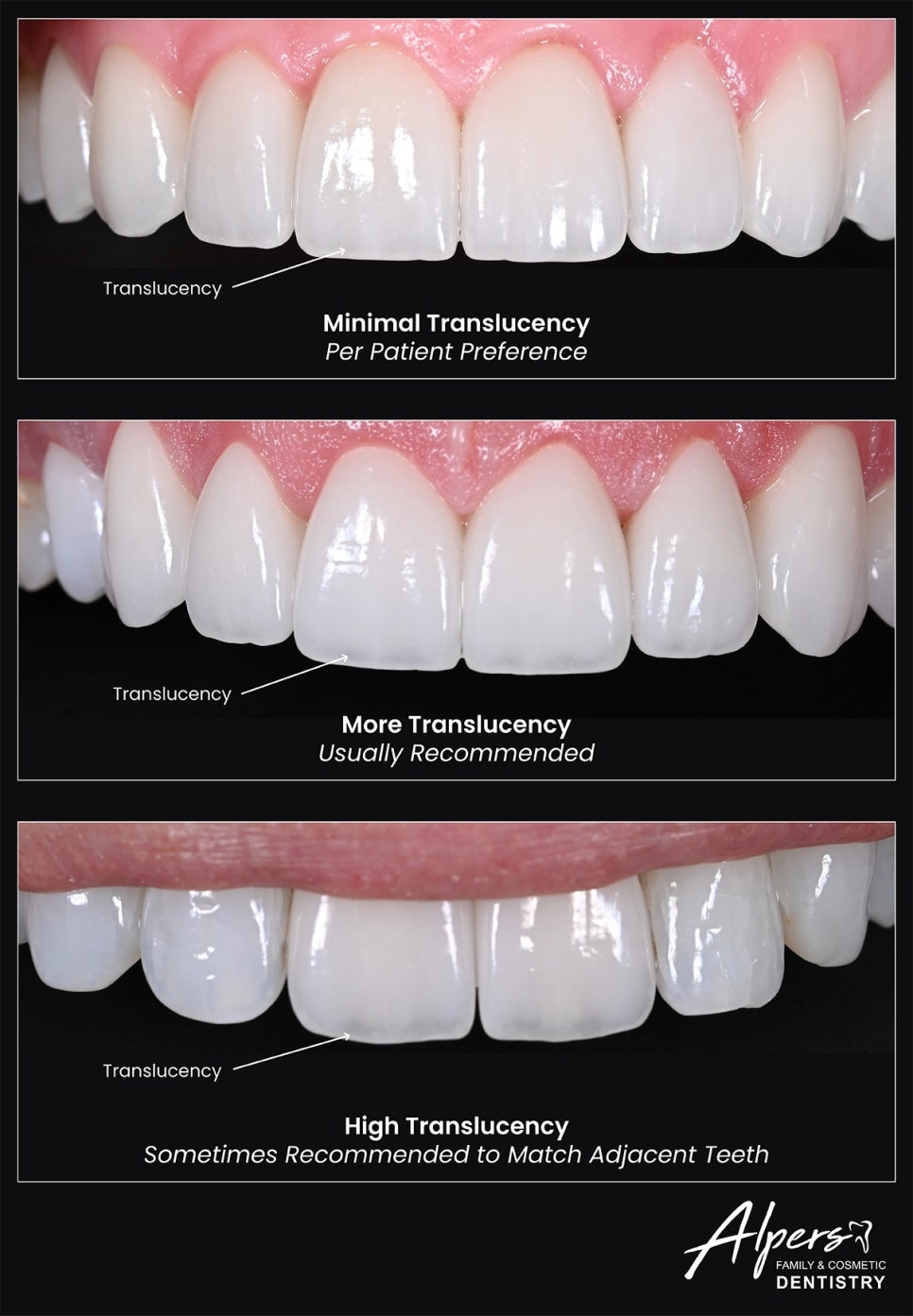 라미네이트 색상, 어떻게 고를까? ‘티 안 나는 자연스러움’의 기준 관련 이미지 5