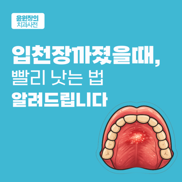 입천장까졌을때, 빨리 낫는 법 알려드립니다