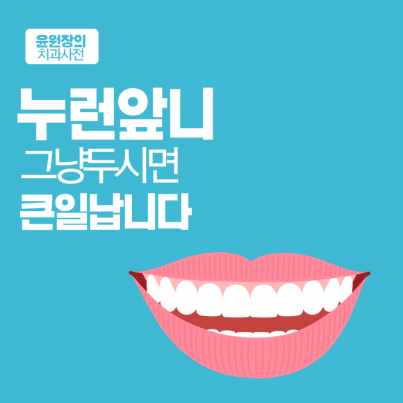 누렁니, 그냥 두시면 큰일납니다.