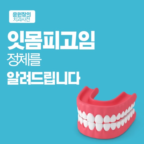 잇몸피고임, 정체를 알려드립니다