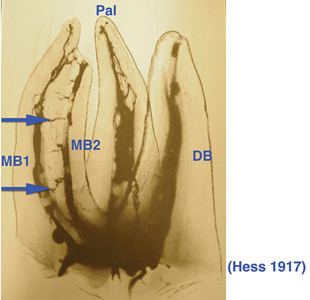 신경치료 전에 꼭 해야 할 검사, 이것이 성공률을 좌우합니다 관련 이미지 5