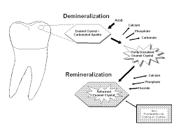 무불소 치약만으로 충분할까? 장단점과 선택 기준 관련 이미지 2