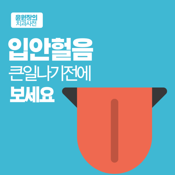 입안헐음, 큰일나기전에 보세요