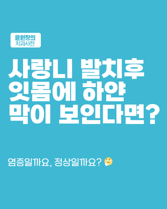 사랑니 발치 후 하얀 막처럼 보인다면? 정상 회복과 내원 신호