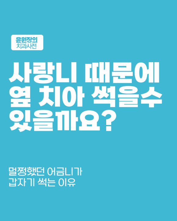 사랑니 때문에 옆 어금니 충치 생길 수 있을까? 실제로 가능한 경우